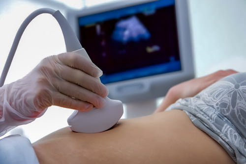 obstetric ultrasound